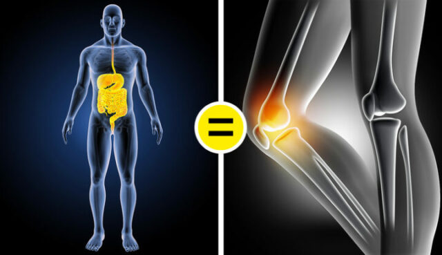 10 Remedies to Relieve Joint Pain
