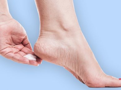 5 tips for treating foot cracks