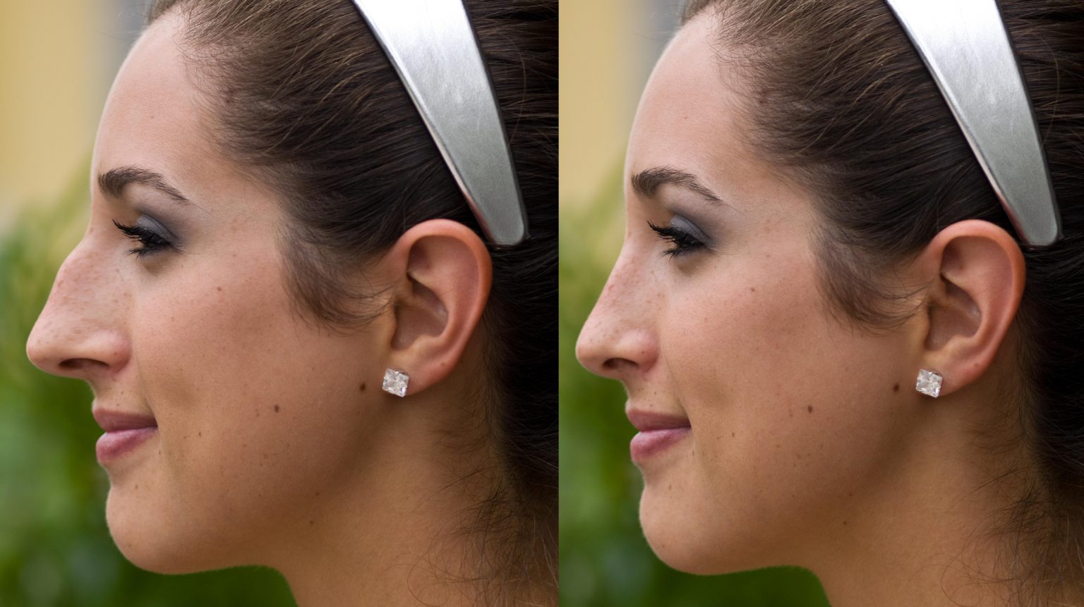 5-myths-about-rhinoplasty