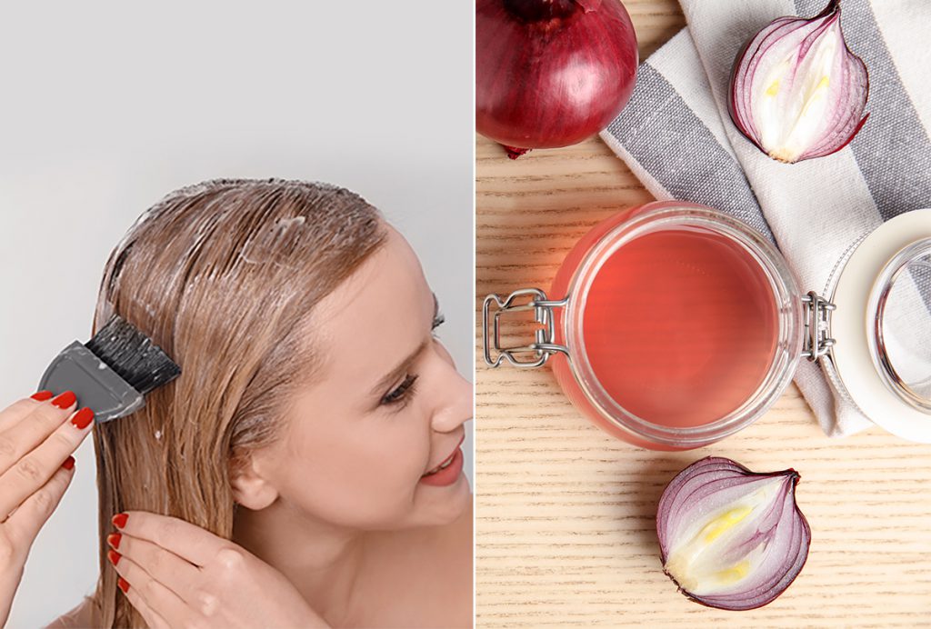 Solutions To Stop Hair Fall With Natural Homemade Diet