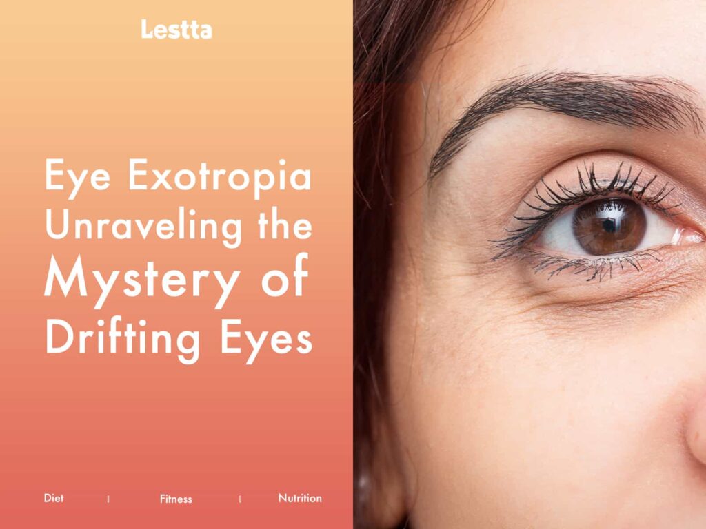 Eye Exotropia Unraveling The Mystery of Drifting Eyes 